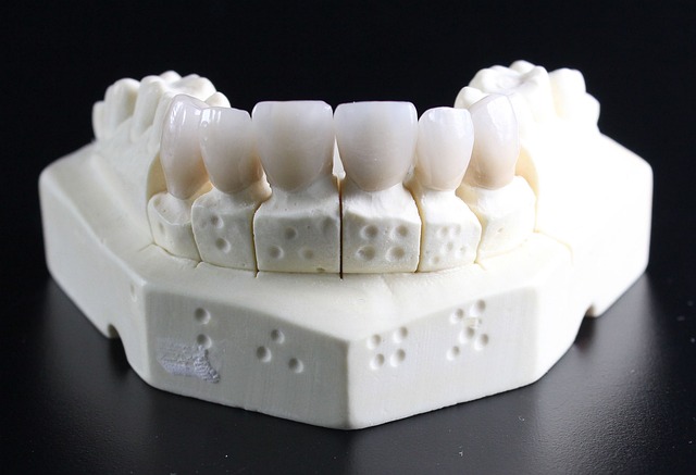 Costo delle Otturazioni in Ceramica