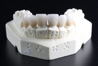 Il ruolo dell'odontotecnico nella realizzazione delle protesi
