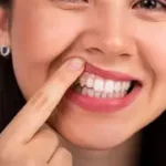 Consigli post-operatori per impianti