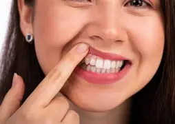 Consigli post-operatori per impianti