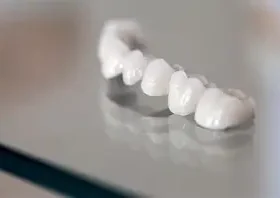 Corone Dentali: Manutenzione e Cura