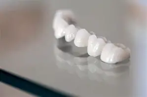 Corone Dentali: Manutenzione e Cura