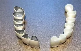 Corone in ceramica vs zirconio