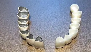 Materiali per corone dentali