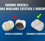 Innovazioni nella Produzione di Corone e Ponti Dentali