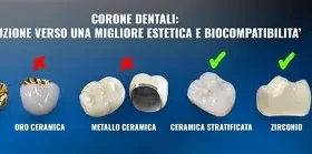 Innovazioni nella Produzione di Corone e Ponti Dentali