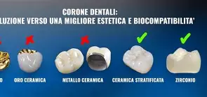 Innovazioni nella Produzione di Corone e Ponti Dentali