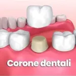 La durata delle corone su dente naturale