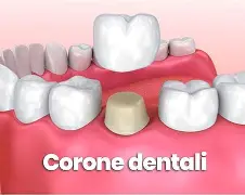 La durata delle corone su dente naturale