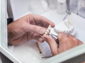 Consigli per la scelta del dentista protesista