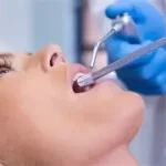 Prevenire la recessione gengivale post-impianto