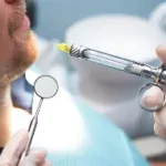 Tecniche di anestesia in implantologia