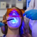 Faccette per Eliminare i Gap tra i Denti