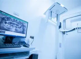 Vantaggi dell'odontoiatria digitale