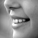 Rinnovamento del sorriso con faccette