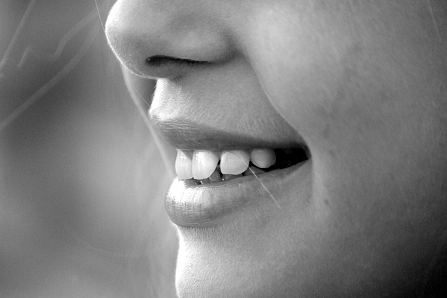 Rinnovamento del sorriso con faccette