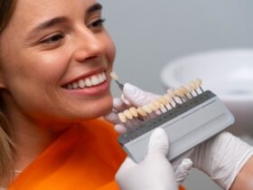 Faccette per Allineamento Dentale: Una Soluzione Estetica e Funzionale