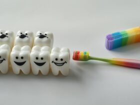 Sfide nel Design delle Faccette Dentali