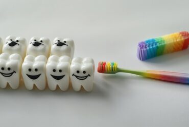 Sfide nel Design delle Faccette Dentali