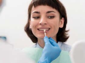 Faccette Dentali Rimovibili: Una Soluzione Estetica Innovativa