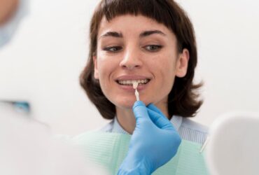 Faccette Dentali Rimovibili: Una Soluzione Estetica Innovativa