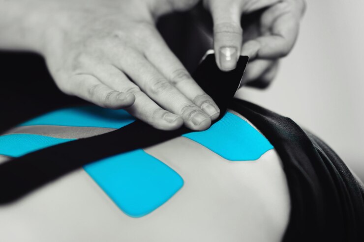 Taping Neuromuscolare: Un Approccio Innovativo in Fisioterapia